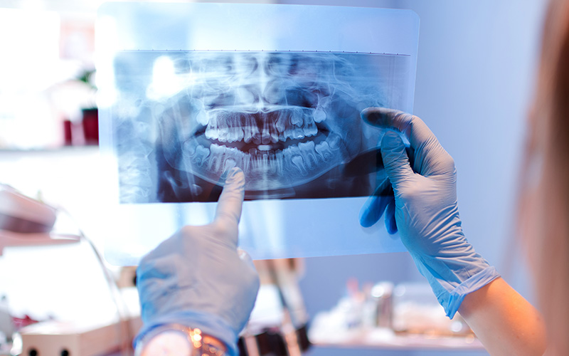 A dental professional examining an X-ray of a patient s teeth using a magnifying glass.